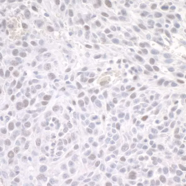 Immunohistochemistry (Formalin/PFA-fixed paraffin-embedded sections) - Anti-ZEB1 antibody (AB245283)