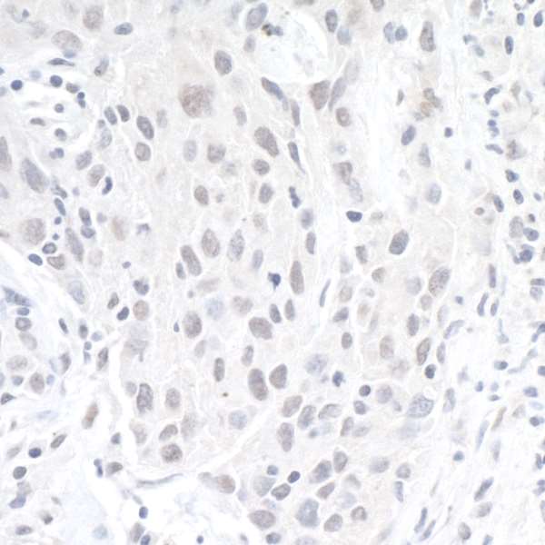 Immunohistochemistry (Formalin/PFA-fixed paraffin-embedded sections) - Anti-ZEB1 antibody (AB245283), expandable thumbnail