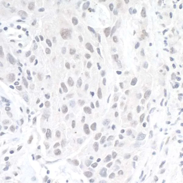 Immunohistochemistry (Formalin/PFA-fixed paraffin-embedded sections) - Anti-ZEB1 antibody (AB245283)