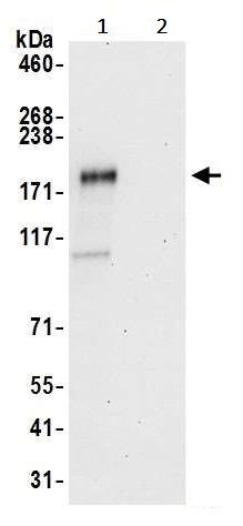 Immunoprecipitation - Anti-ZEB1 antibody (AB245283), expandable thumbnail