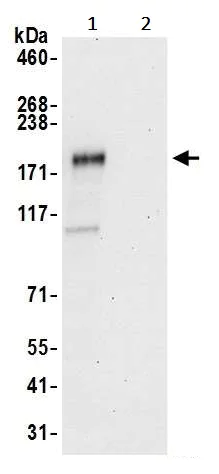 Immunoprecipitation - Anti-ZEB1 antibody (AB245283)