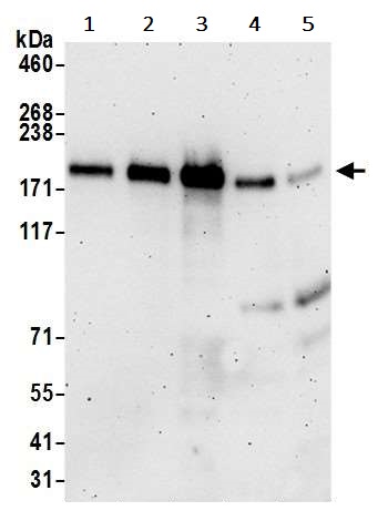 Western blot - Anti-ZEB1 antibody (AB245283), expandable thumbnail