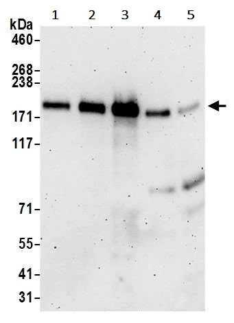 Western blot - Anti-ZEB1 antibody (AB245283)