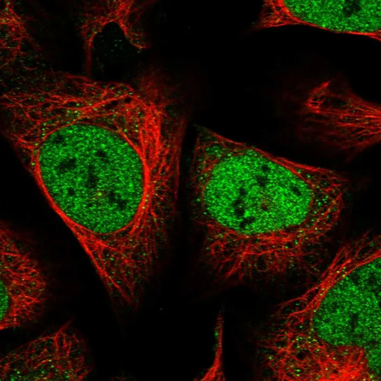Immunocytochemistry/ Immunofluorescence - Anti-ZEB1 Antibody (AB327209)