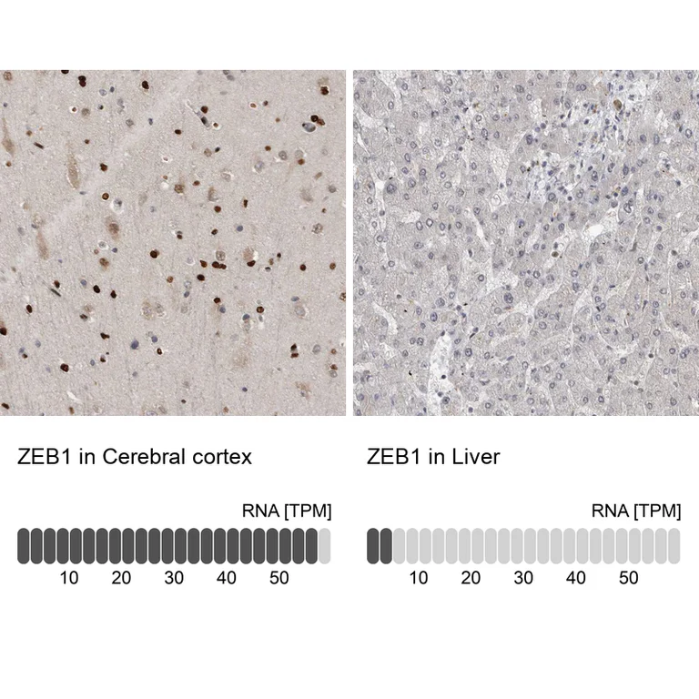 Immunohistochemistry (Formalin/PFA-fixed paraffin-embedded sections) - Anti-ZEB1 Antibody (AB327209)