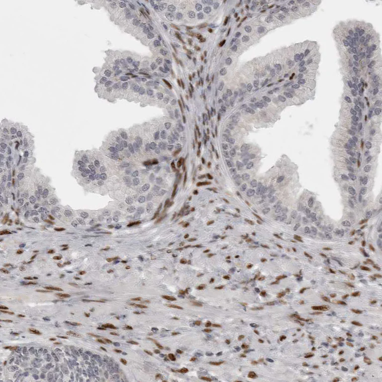 Immunohistochemistry (Formalin/PFA-fixed paraffin-embedded sections) - Anti-ZEB1 Antibody (AB327209)