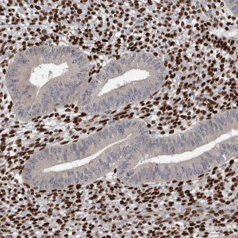 Immunohistochemistry (Formalin/PFA-fixed paraffin-embedded sections) - Anti-ZEB1 Antibody (AB327209)