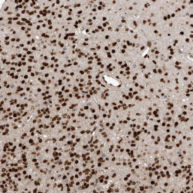 Immunohistochemistry (Formalin/PFA-fixed paraffin-embedded sections) - Anti-ZEB1 Antibody (AB327209)
