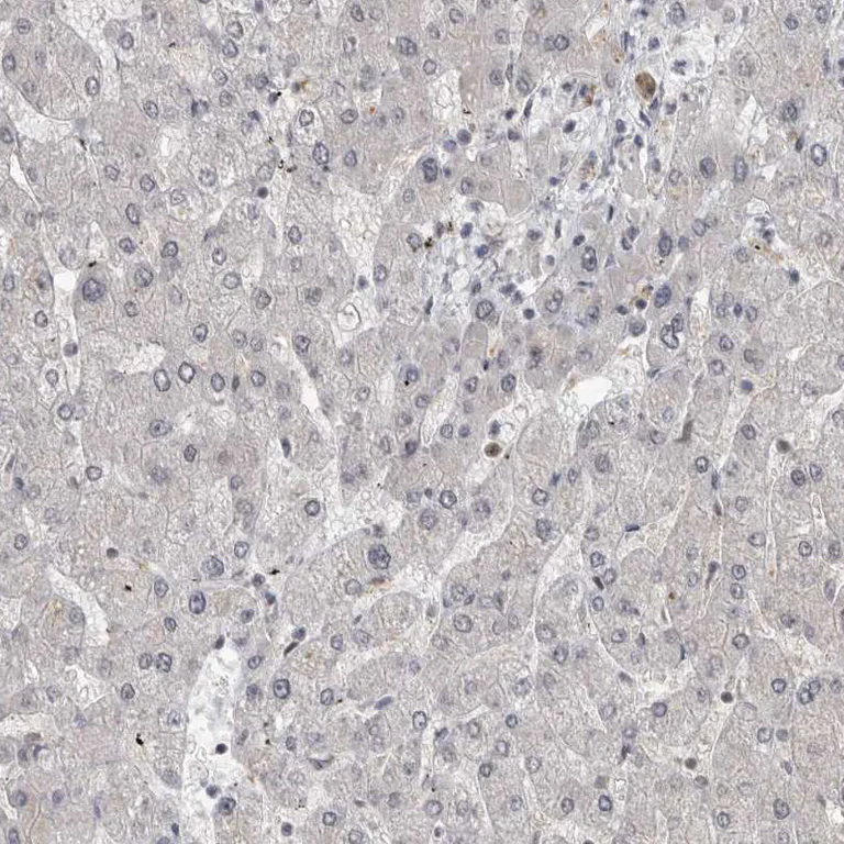 Immunohistochemistry (Formalin/PFA-fixed paraffin-embedded sections) - Anti-ZEB1 Antibody (AB327209)