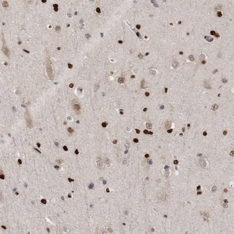 Immunohistochemistry (Formalin/PFA-fixed paraffin-embedded sections) - Anti-ZEB1 Antibody (AB327209)