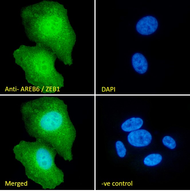 Immunocytochemistry/ Immunofluorescence - Anti-ZEB1 antibody (AB81972), expandable thumbnail
