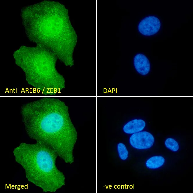 Immunocytochemistry/ Immunofluorescence - Anti-ZEB1 antibody (AB81972)