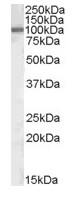 Western blot - Anti-ZEB1 antibody (AB81972), expandable thumbnail
