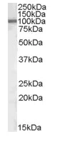 Western blot - Anti-ZEB1 antibody (AB81972)