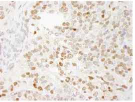 Immunohistochemistry (Formalin/PFA-fixed paraffin-embedded sections) - Anti-ZEB1 antibody (AB87280)