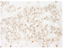 Immunohistochemistry (Formalin/PFA-fixed paraffin-embedded sections) - Anti-ZEB1 antibody (AB87280), expandable thumbnail