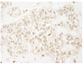 Immunohistochemistry (Formalin/PFA-fixed paraffin-embedded sections) - Anti-ZEB1 antibody (AB87280)