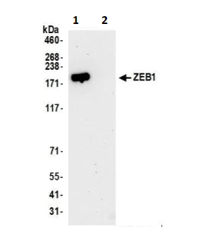Immunoprecipitation - Anti-ZEB1 antibody [BLR102H] (AB276129)