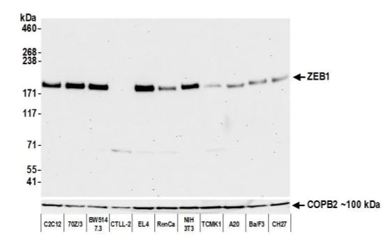 Western blot - Anti-ZEB1 antibody [BLR102H] (AB276129)