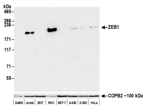 Western blot - Anti-ZEB1 antibody [BLR102H] (AB276129)
