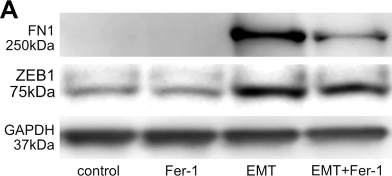 Western blot - Anti-ZEB1 antibody [BLR102H] (AB276129)