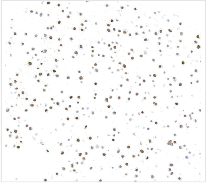Immunocytochemistry - Anti-ZEB1 antibody [BLR217K] - BSA free (AB314092)