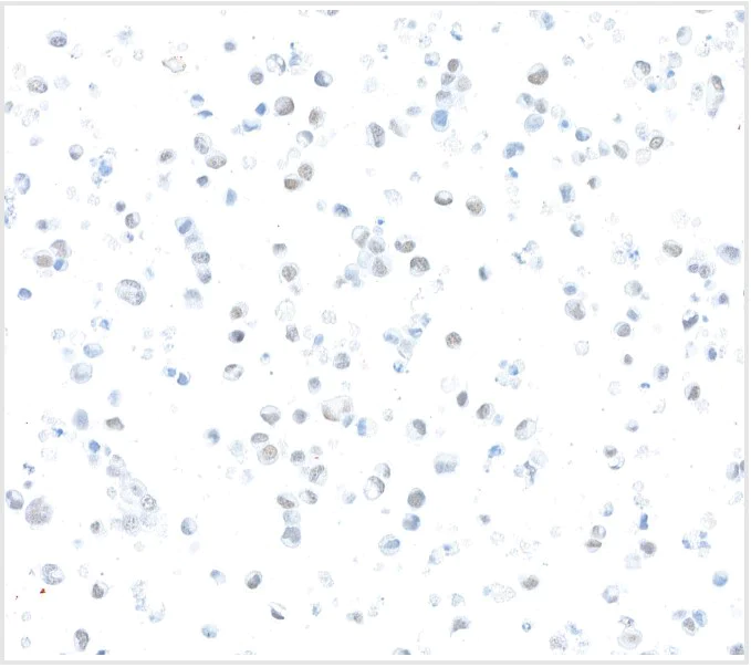 Immunocytochemistry - Anti-ZEB1 antibody [BLR217K] - BSA free (AB314092)