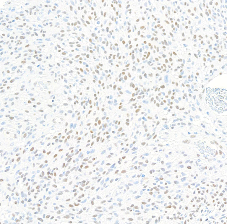 Immunohistochemistry (Formalin/PFA-fixed paraffin-embedded sections) - Anti-ZEB1 antibody [BLR217K] - BSA free (AB314092)