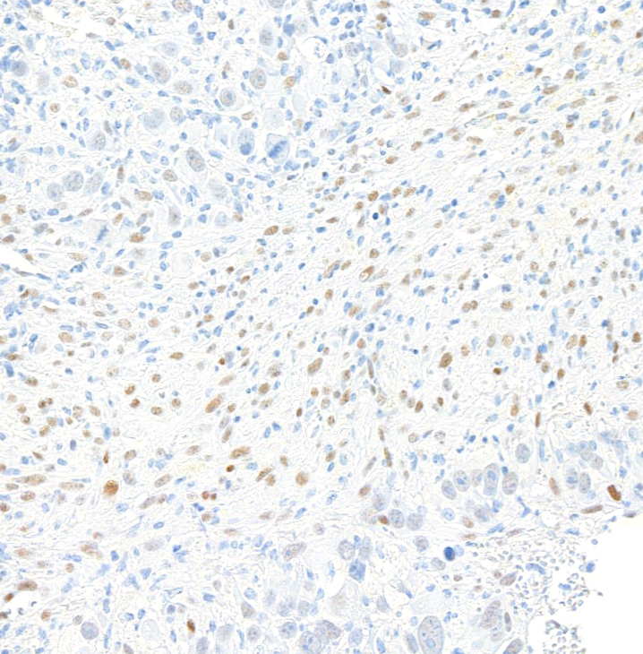 Immunohistochemistry (Formalin/PFA-fixed paraffin-embedded sections) - Anti-ZEB1 antibody [BLR217K] - BSA free (ab314092), expandable thumbnail