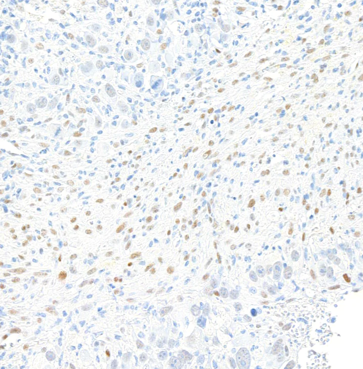 Immunohistochemistry (Formalin/PFA-fixed paraffin-embedded sections) - Anti-ZEB1 antibody [BLR217K] - BSA free (AB314092)