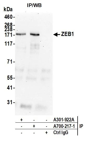 Immunoprecipitation - Anti-ZEB1 antibody [BLR217K] - BSA free (AB314092)