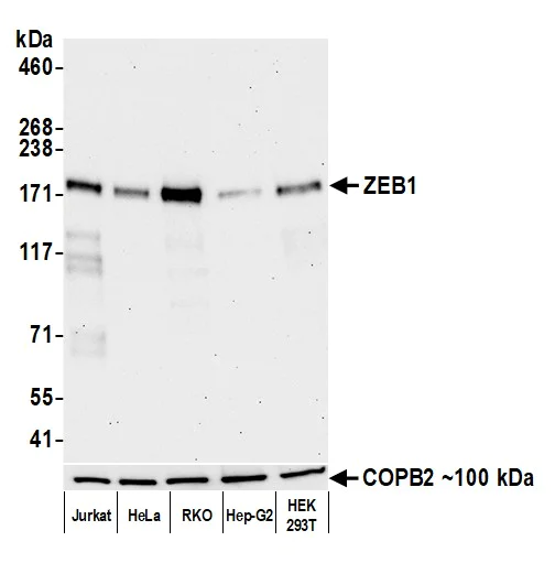 Western blot - Anti-ZEB1 antibody [BLR217K] - BSA free (AB314092)