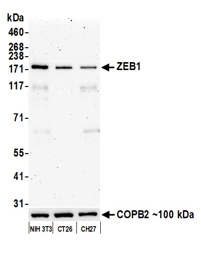 Western blot - Anti-ZEB1 antibody [BLR217K] - BSA free (AB314092), expandable thumbnail
