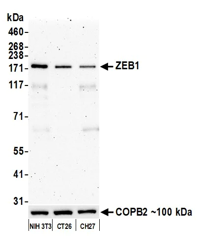 Western blot - Anti-ZEB1 antibody [BLR217K] - BSA free (AB314092)