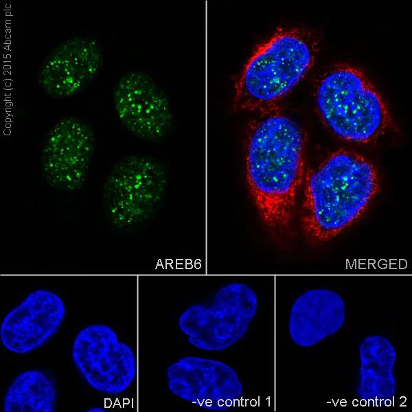 Immunocytochemistry/ Immunofluorescence - Anti-ZEB1 antibody [EPR17375] (AB203829)
