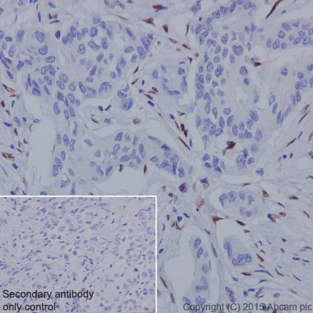 Immunohistochemistry (Formalin/PFA-fixed paraffin-embedded sections) - Anti-ZEB1 antibody [EPR17375] (AB203829)