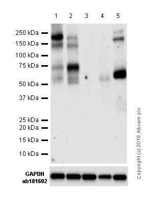 Western blot - Anti-ZEB1 antibody [EPR17375] (AB203829)