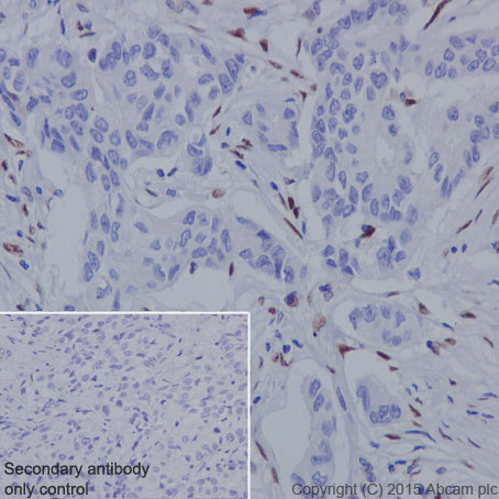 Immunohistochemistry (Formalin/PFA-fixed paraffin-embedded sections) - Anti-ZEB1 antibody [EPR17375] - BSA and Azide free (AB228986), expandable thumbnail