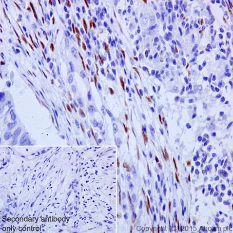Immunohistochemistry (Formalin/PFA-fixed paraffin-embedded sections) - Anti-ZEB1 antibody [EPR17375] - BSA and Azide free (AB228986)