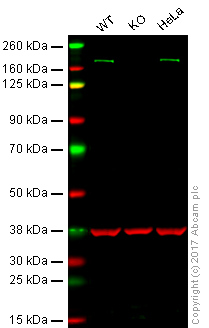 Western blot - Anti-ZEB1 antibody [EPR17375] - BSA and Azide free (AB228986), expandable thumbnail