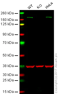 Western blot - Anti-ZEB1 antibody [EPR17375] - BSA and Azide free (AB228986)