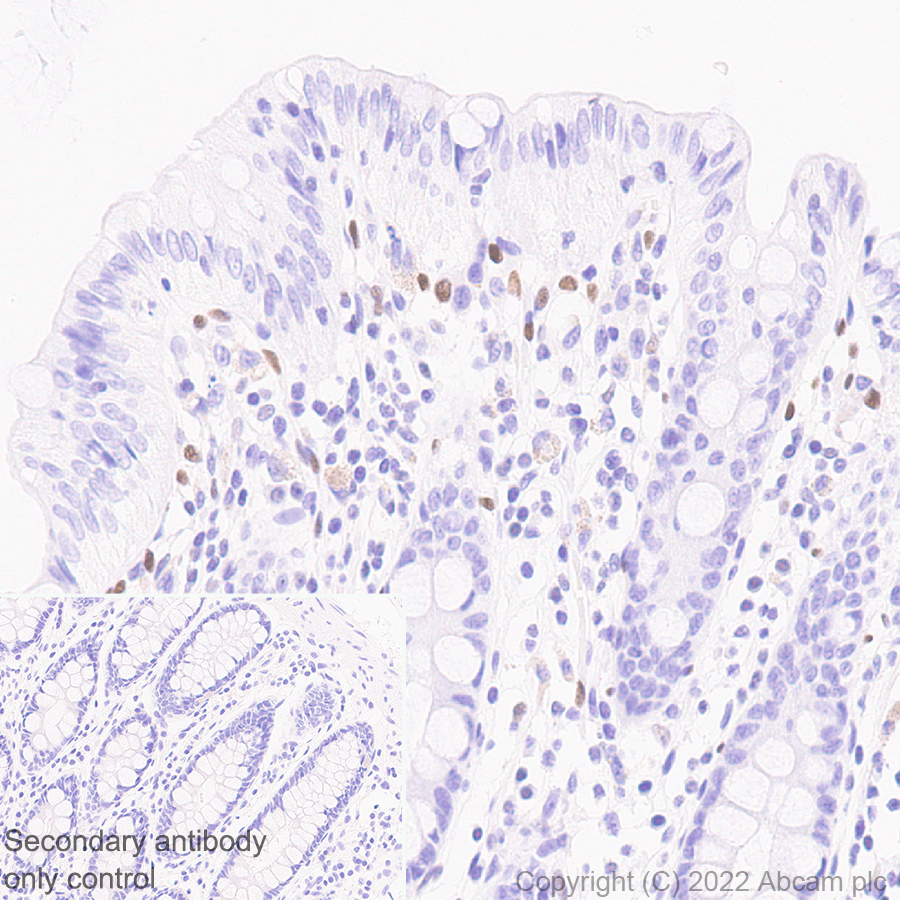 Immunohistochemistry (Formalin/PFA-fixed paraffin-embedded sections) - Anti-ZEB1 antibody [EPR26184-63] (ab303480), expandable thumbnail