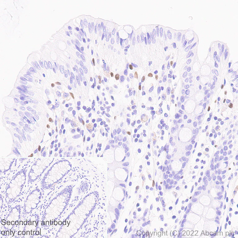 Anti-ZEB1 antibody [EPR26184-63] (ab303480) | Abcam