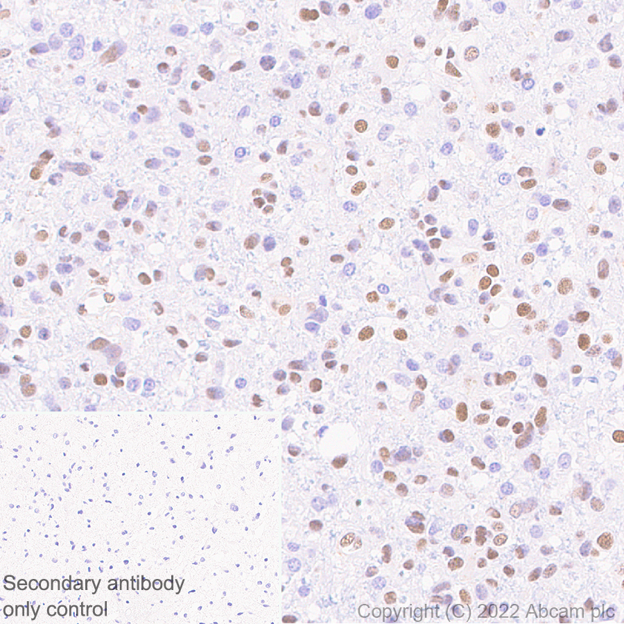Immunohistochemistry (Formalin/PFA-fixed paraffin-embedded sections) - Anti-ZEB1 antibody [EPR26184-63] (AB303480), expandable thumbnail