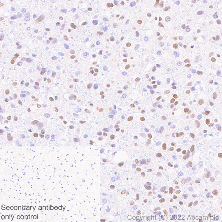 Immunohistochemistry (Formalin/PFA-fixed paraffin-embedded sections) - Anti-ZEB1 antibody [EPR26184-63] (AB303480)