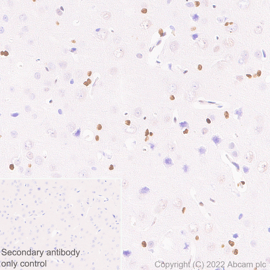 Immunohistochemistry (Formalin/PFA-fixed paraffin-embedded sections) - Anti-ZEB1 antibody [EPR26184-63] (AB303480), expandable thumbnail