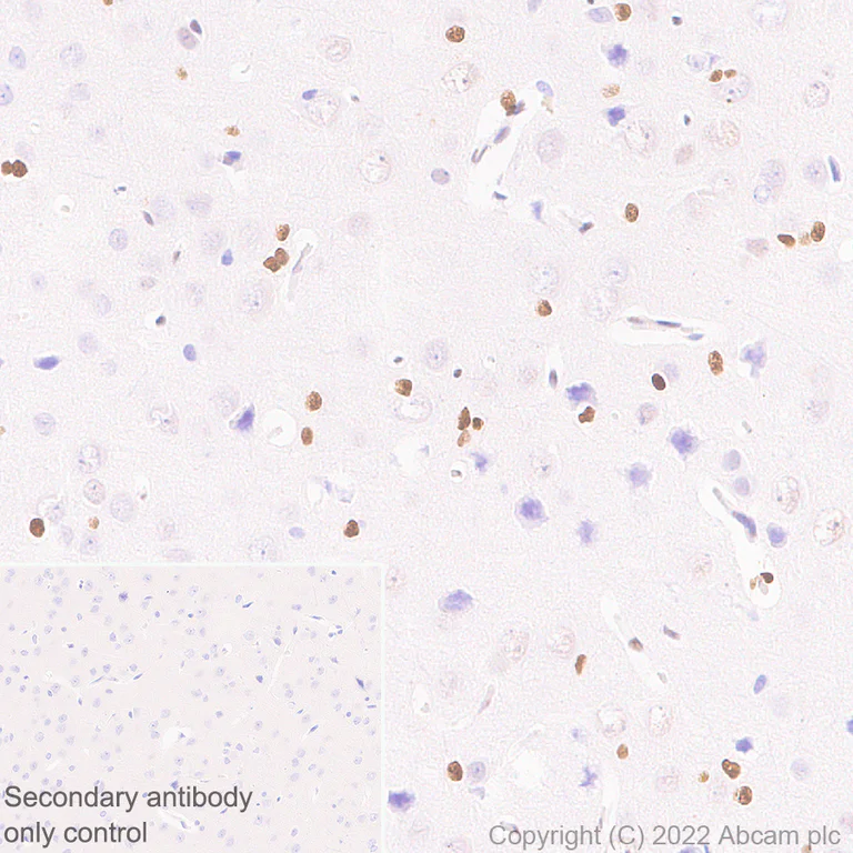 Immunohistochemistry (Formalin/PFA-fixed paraffin-embedded sections) - Anti-ZEB1 antibody [EPR26184-63] (AB303480)