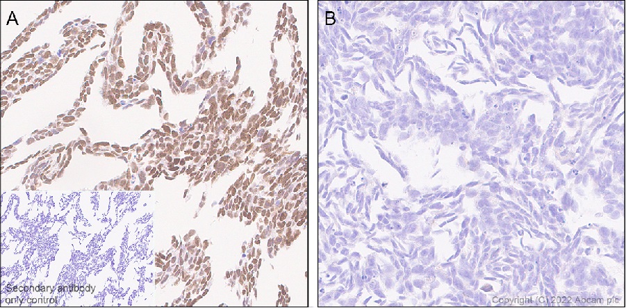 Immunohistochemistry (Formalin/PFA-fixed paraffin-embedded sections) - Anti-ZEB1 antibody [EPR26184-63] (AB303480), expandable thumbnail