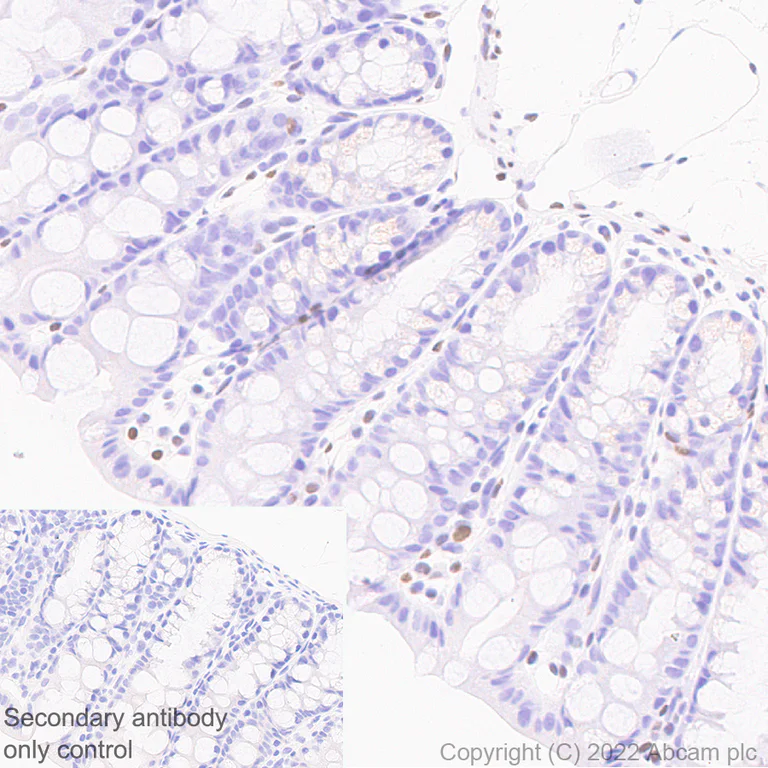 Immunohistochemistry (Formalin/PFA-fixed paraffin-embedded sections) - Anti-ZEB1 antibody [EPR26184-63] - BSA and Azide free (AB303481)