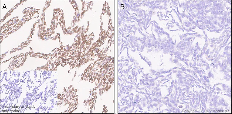 Immunohistochemistry (Formalin/PFA-fixed paraffin-embedded sections) - Anti-ZEB1 antibody [EPR26184-63] - BSA and Azide free (AB303481)
